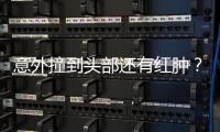 意外撞到头部还有红肿？昆凌回应：好多了